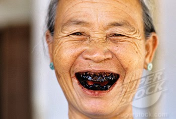 black teeth.jpg